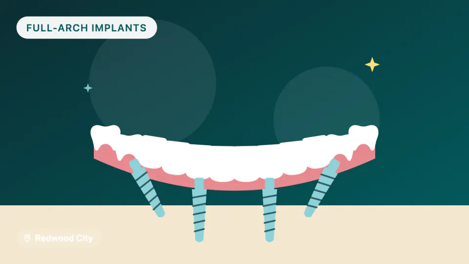 All-on-4 Implants in Redwood City, CA: Materials & Timeline