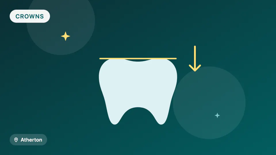 Dental Crowns in Atherton: Zirconia vs Lithium Disilicate vs 3D-Printed