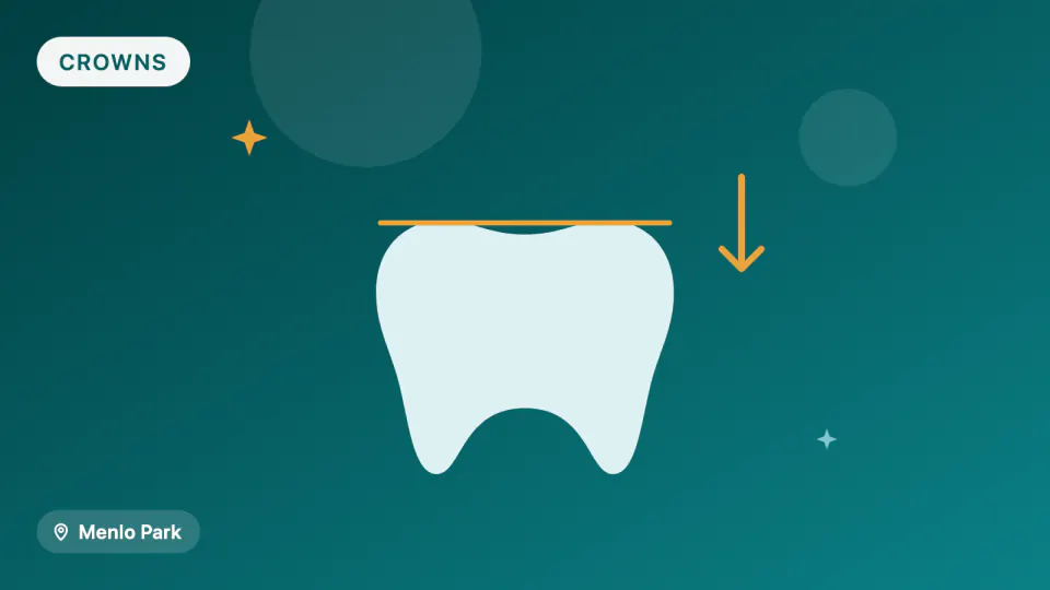 Menlo Park Crowns: Zirconia vs. Lithium Disilicate vs. 3D-Printed