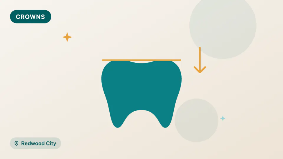 Dental Crowns in Redwood City: Zirconia, Lithium Disilicate, or 3D-Printed?