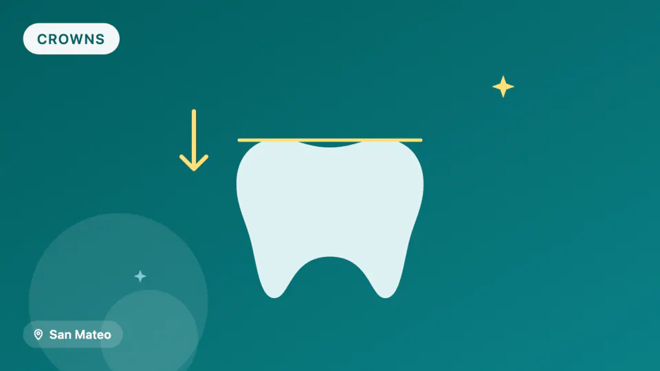Dental Crowns in San Mateo: Zirconia, Lithium Disilicate or 3D-Printed?