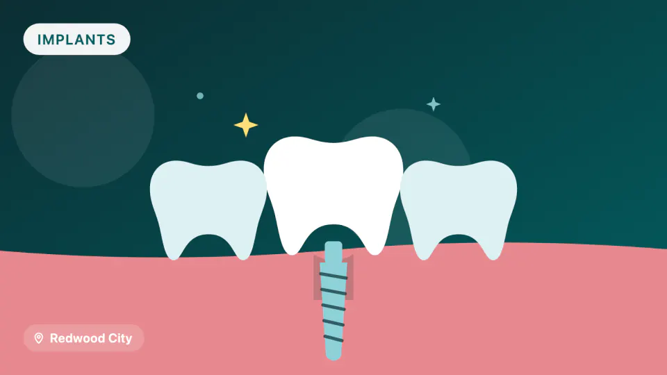 Dental Implant Maintenance in Redwood City: Why Recalls Matter