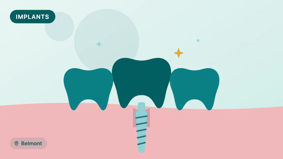 Dental Implants in Belmont, CA: Screening & Long-Term Success