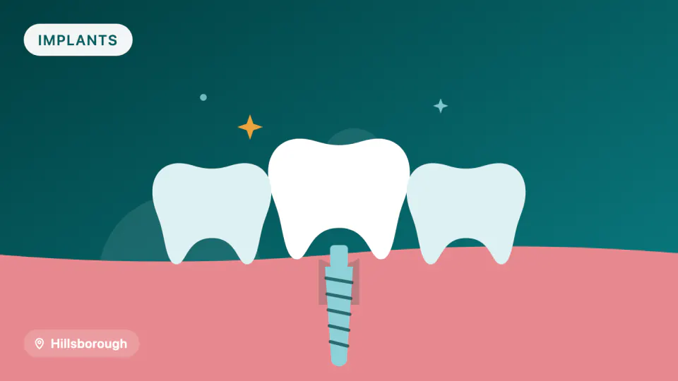 Dental Implants in Hillsborough, CA: Screening & Long-Term Success