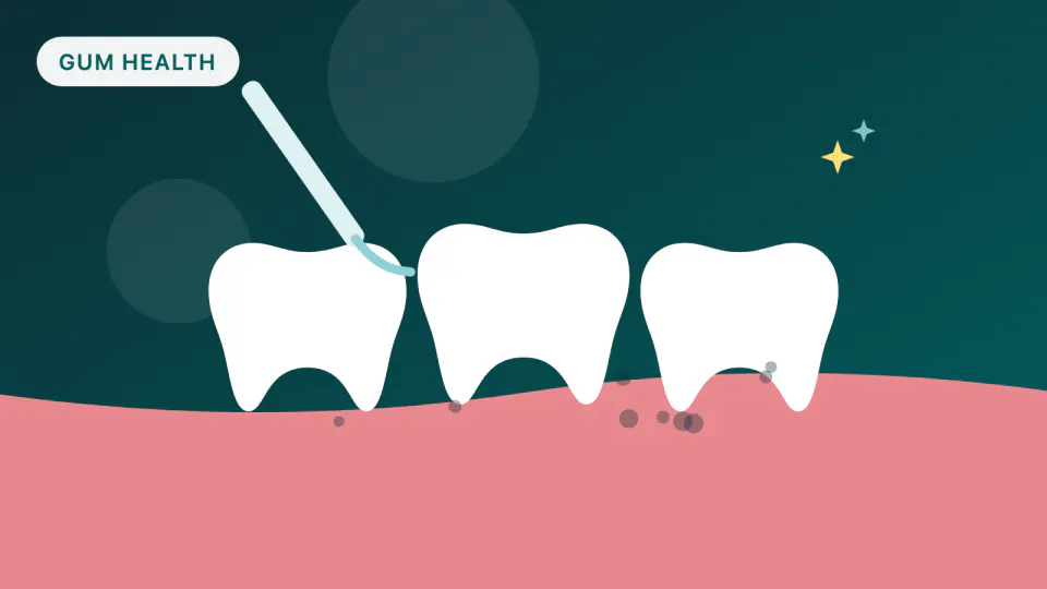 Gum Disease and Deep Cleanings on HPSM Medi-Cal: South San Francisco