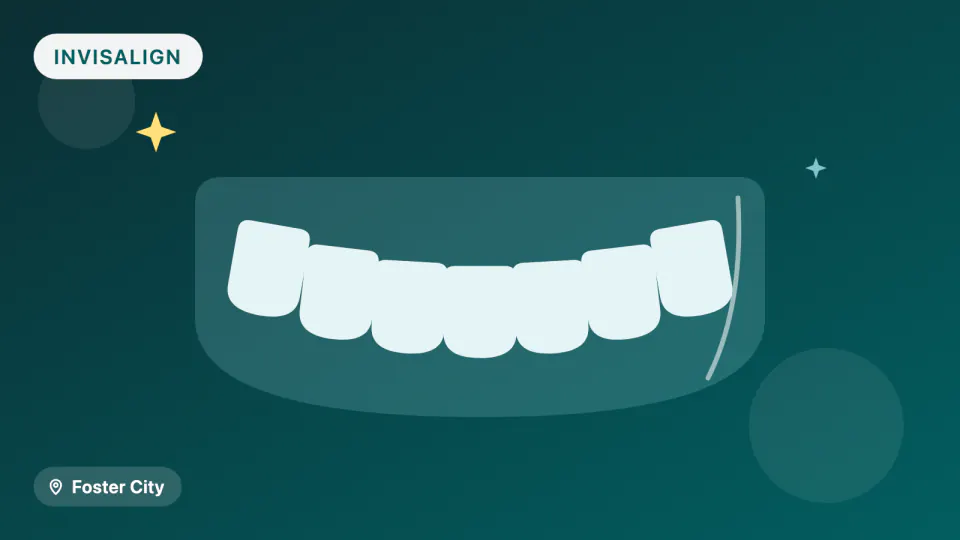 Invisalign in Foster City: What 2026 Trials Say About Speed & Bite Fix