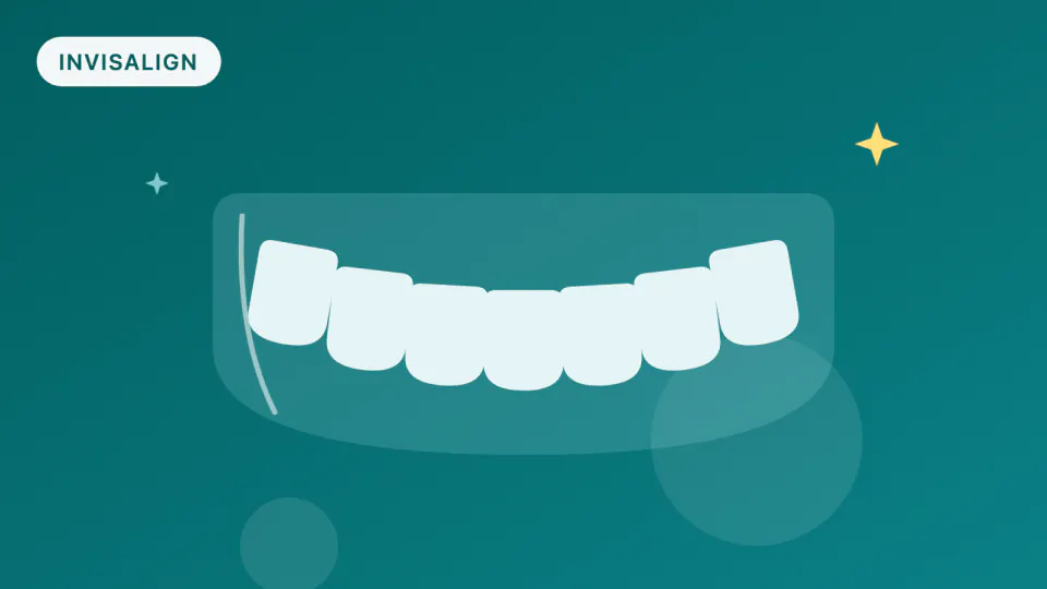Invisalign Mandibular Advancement: Does It Grow a Teen's Jaw?