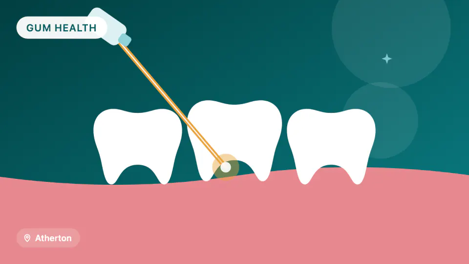 LANAP Laser Gum Treatment in Atherton: What the Research Shows