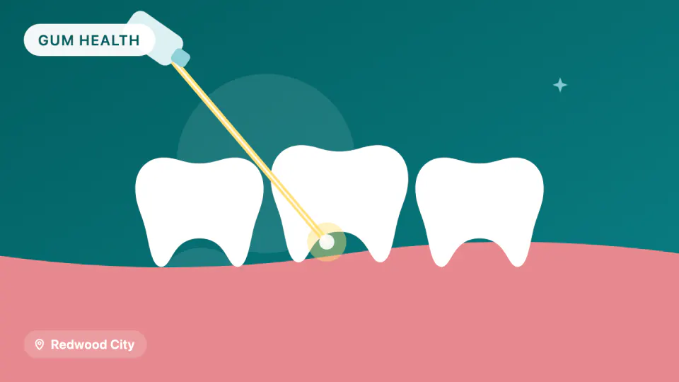 LANAP Laser Gum Treatment: What to Know Before Choosing It