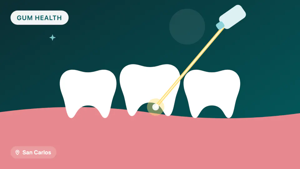 Laser Gum Treatment for San Carlos, CA Patients
