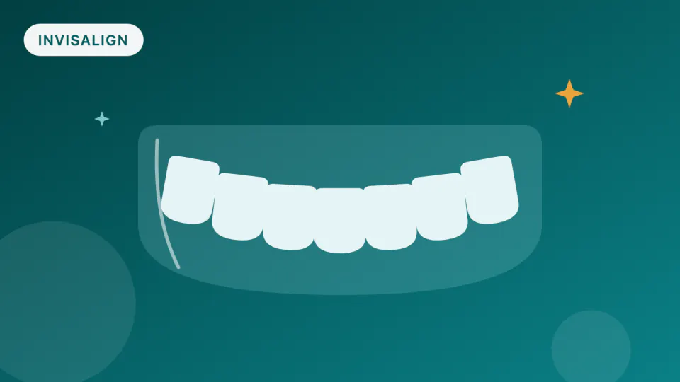 Mail-Order Aligners vs. Dentist-Supervised Invisalign (2025)