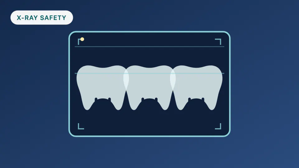 Dental X-Rays and Exams on HPSM Medi-Cal: Burlingame Guide