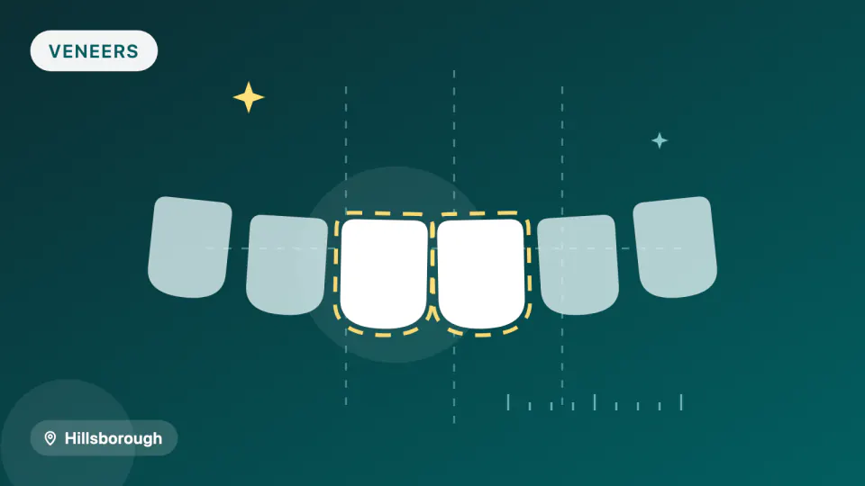 Porcelain vs Composite Veneers: 2026 Chewing Study (Hillsborough)