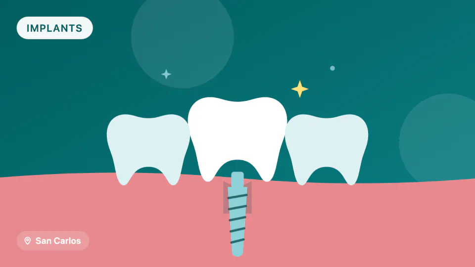 Same-Day Implants After Extraction in San Carlos, CA: Are You a Candidate?