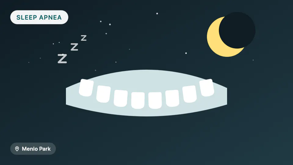 Sleep Apnea Oral Appliances vs CPAP: 2026 Evidence for Menlo Park