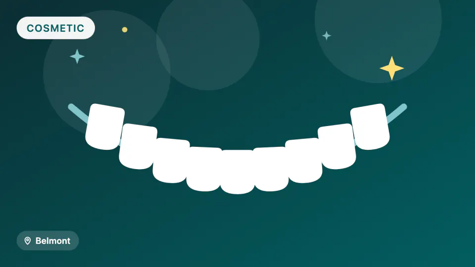 Smile Makeover in Belmont, CA: Digital Planning & Materials