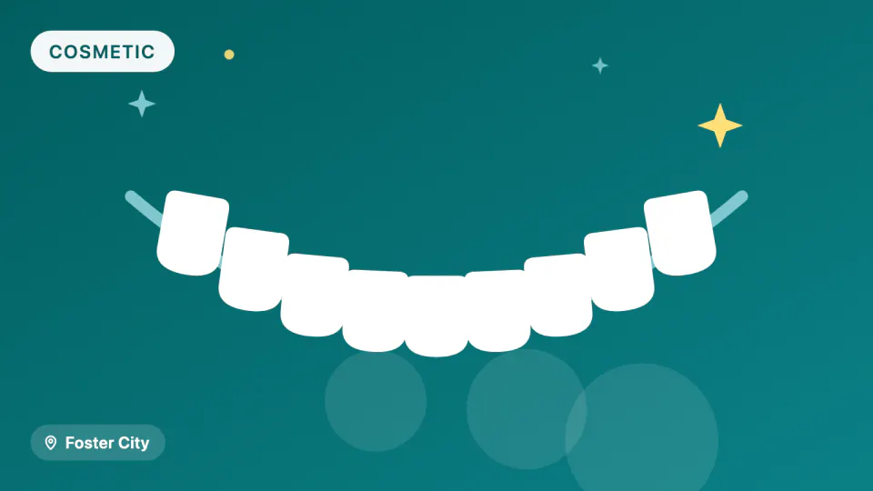 Smile Makeover in Foster City: Digital Planning & Material Choice
