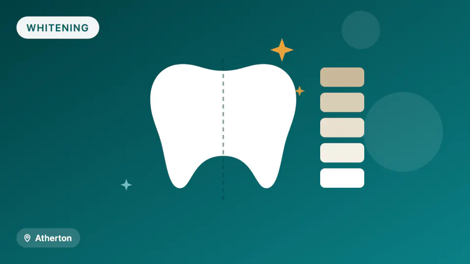 Teeth Whitening in Atherton: Strength vs. Sensitivity in 2026