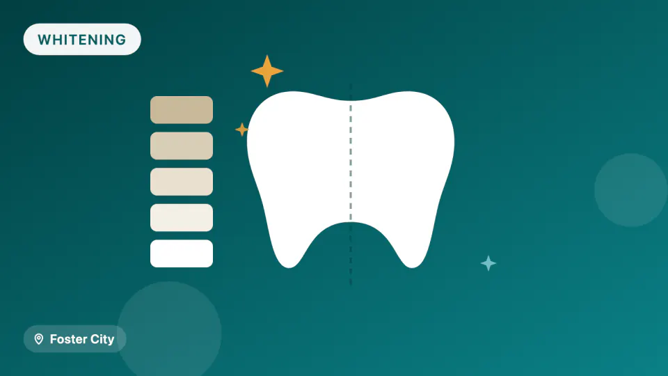 Teeth Whitening in Foster City, CA: Strength vs. Sensitivity