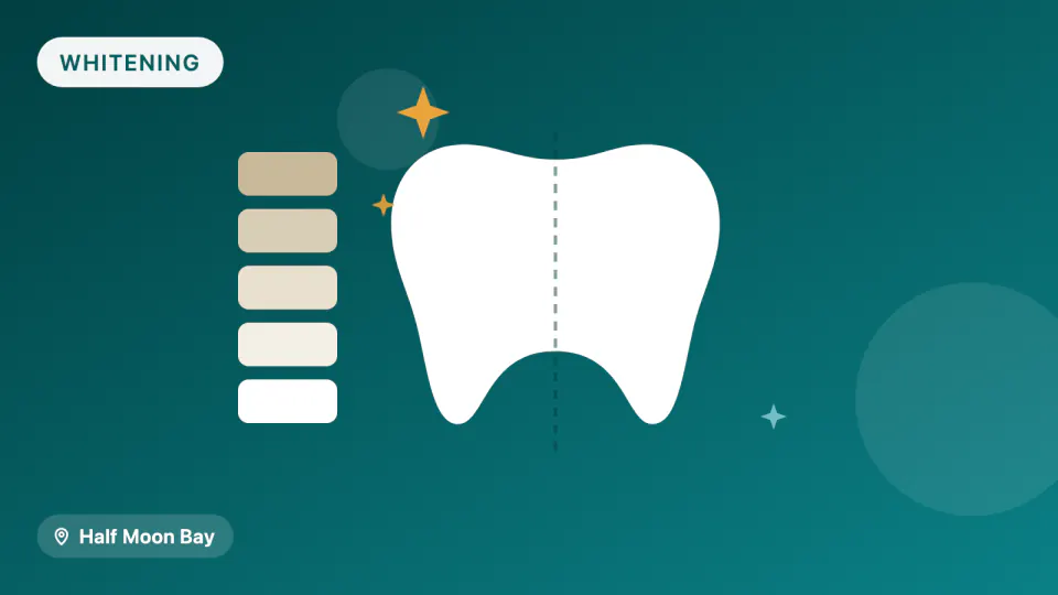 Teeth Whitening in Half Moon Bay: Strength vs. Sensitivity