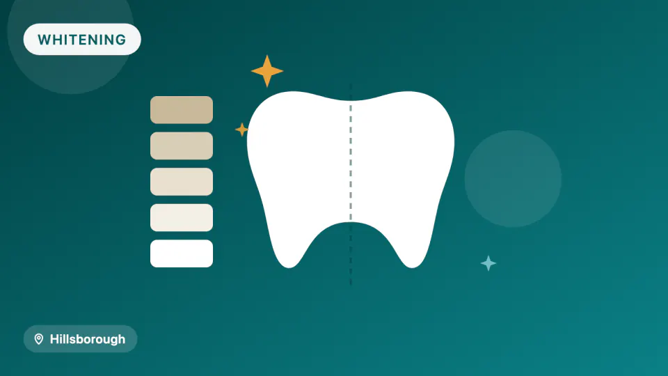 Teeth Whitening Near Hillsborough: Strength vs. Sensitivity