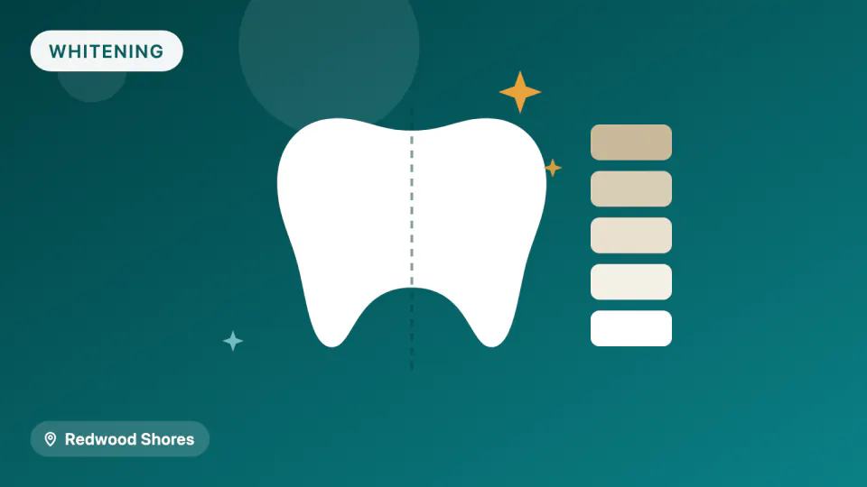 Teeth Whitening in Redwood Shores: Strength vs. Sensitivity