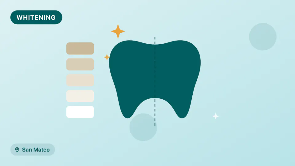 Teeth Whitening in San Mateo: What the 2026 Trials Show