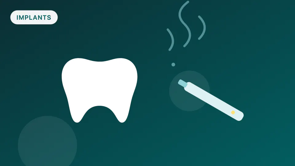 Does Vaping Affect Dental Implants? What 2025 Research Shows