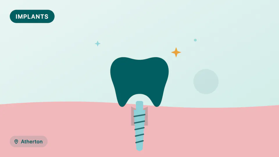 Metal-Free Zirconia Implants: What the Research Shows for Atherton Patients