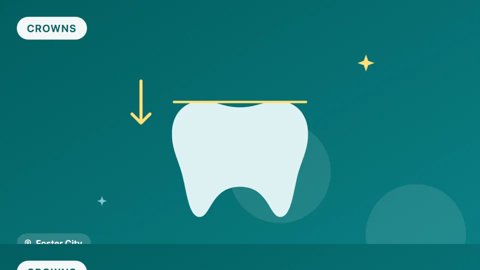 Zirconia vs. Porcelain Crowns: Which Lasts and Which Chips