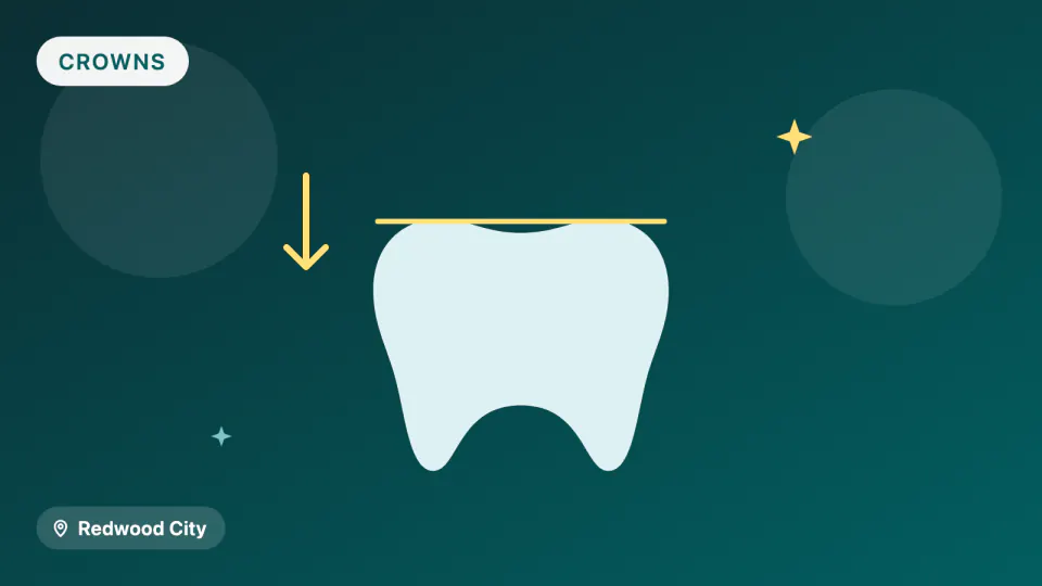 Zirconia vs. Porcelain Crowns: Which Lasts and Which Chips
