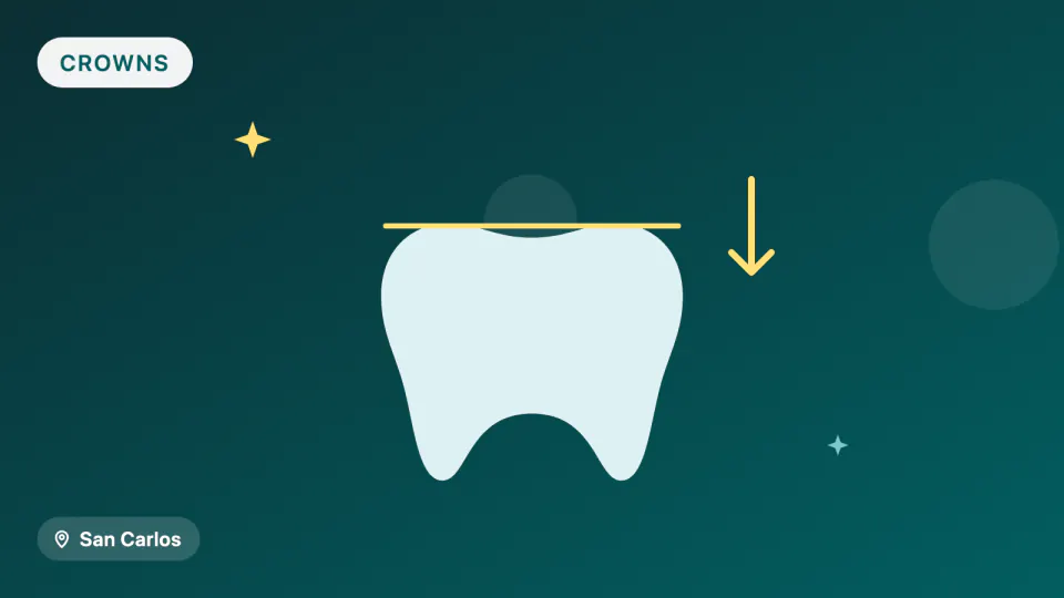 Zirconia vs. Porcelain Crowns: Which Lasts, Which Chips