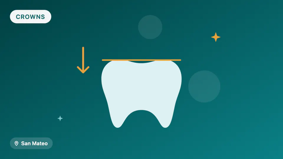 Zirconia vs. Porcelain Crowns: Which Lasts and Which Chips